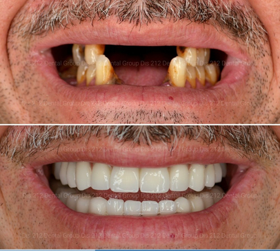 Slider image (7) Dis 212 - Dental Aesthetics Facility